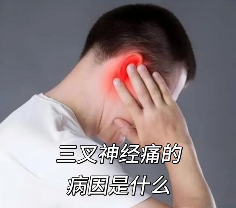 三叉神经痛.jpg 三叉神经痛.jpg